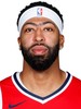 Anthony Davis